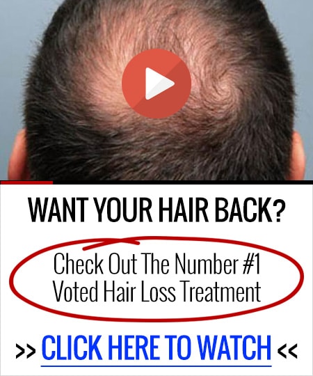 50+ Hair Growth Treatment For Men Pics