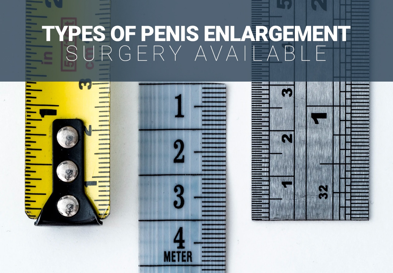 Male Enhancement Surgery Options